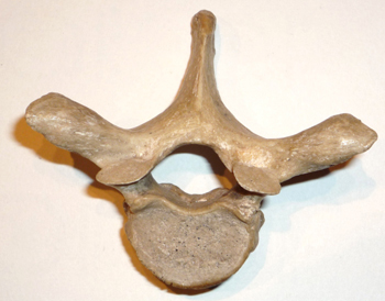 Vrtebra dorsal